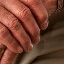 An elderly persons hands, crossed over one another.